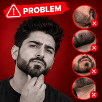 Man with an uneven beard looking concerned, showing common beard grooming problems.