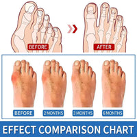 Detailed inside view showing the soft skin-friendly internal padding cushion of the bunion support